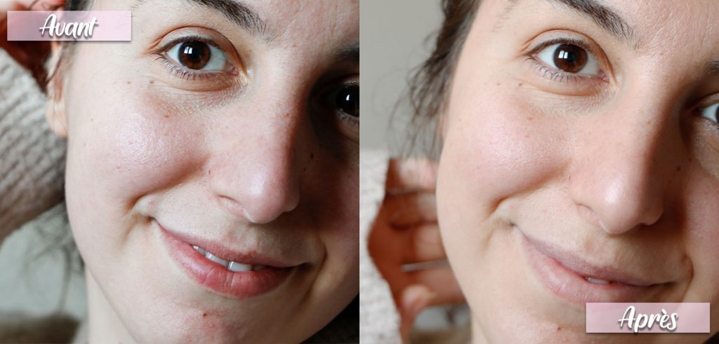 Avant-après-apicia-soin-visage-teint-progressif